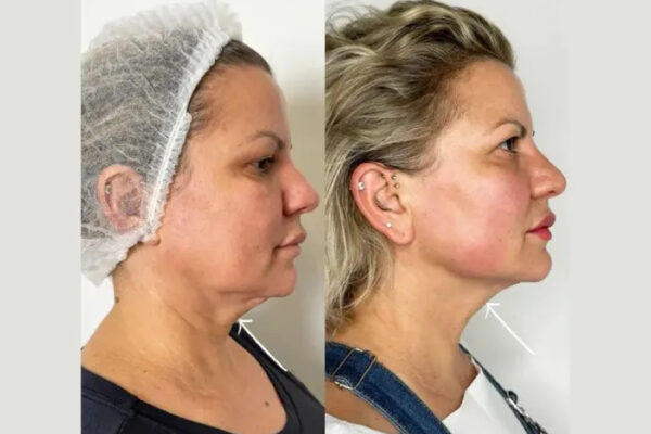 Celebrity Clinic Excellence Among Best Aesthetic Clinics in Dubai Celebrity Clinic Excellence Among Best Aesthetic Clinics in Dubai