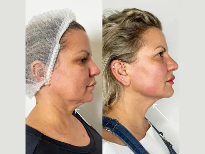 Celebrity Clinic Excellence Among Best Aesthetic Clinics in Dubai