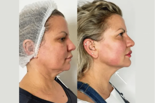 Best Aesthetic Clinic in Dubai for Natural, Lasting Results