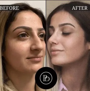 The Science Behind PRP Treatments in Dubai