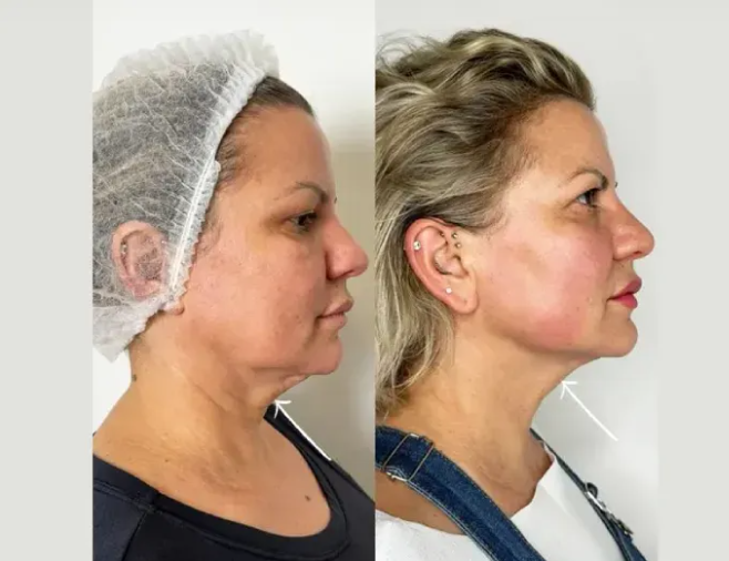 Best Aesthetic Clinics in Dubai for Natural PRP Results